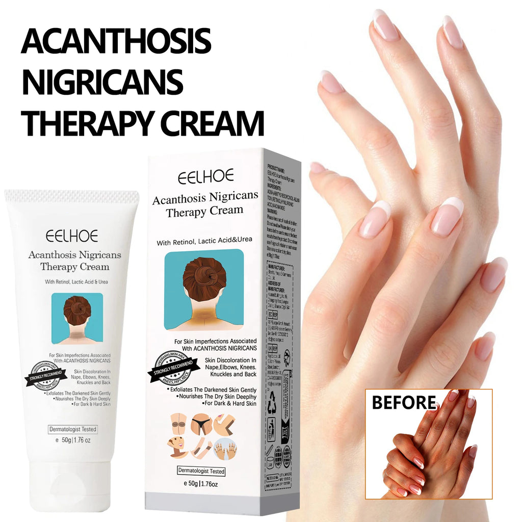 EELHOE Skin Brightening Whitening Cream – Neck, Elbow & Body Body Brightening Cream Oasis Select