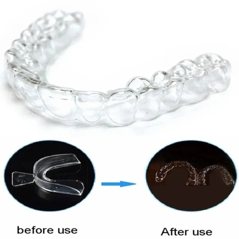 1/3/6pairs Silicone Mouth Guard Sleeping Mouth Guard Tray Orthodontic Braces Set For Bruxism Non-Snoring Teeth Whitening Protect Oasis Select