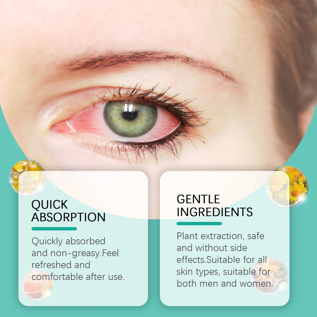 Eye Comfort Care Roller – Gentle Massage Eye Cream 10ml Eye Roller Cream Oasis Select