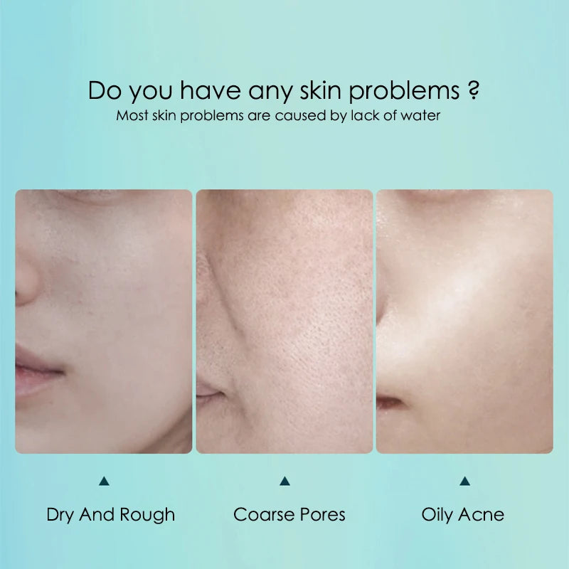 BIOAOUA Hyaluronic Acid Sheet Masks 10-Pack – Hydrate & Pores Hydrating Sheet Mask Oasis Select