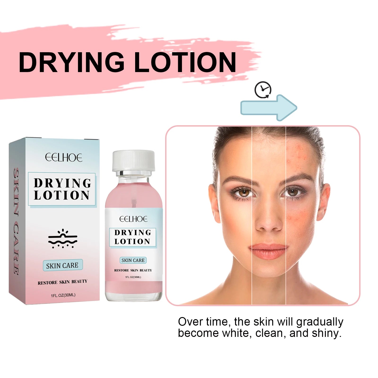 EELHOE Salicylic Acid Acne Lotion – Pores & Blackheads 30ml