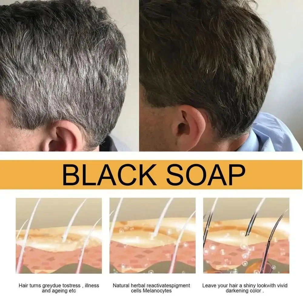 Hair Shampoo Soap Polygonum Multiflorum Black Soap White Hair Repair Soap Hair Care Set Nourishing Anti Dandruff Hair Dye Soap Oasis Select