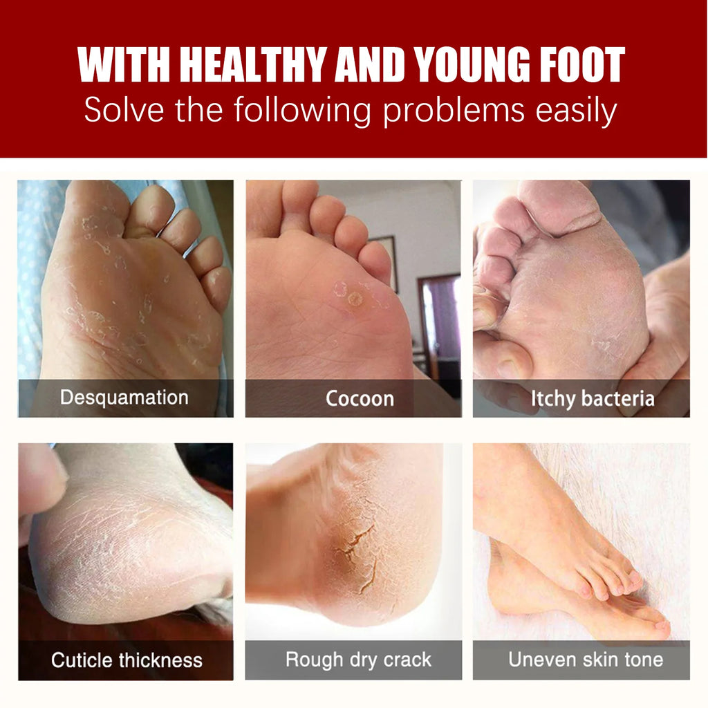 AHA Exfoliating Foot Mask – Dead Skin & Cracked Heel Peel Exfoliating Foot Mask Oasis Select