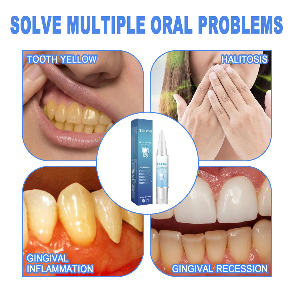 EELHOE Teeth Whitening Gel Gum Repair Treatment Dental Cleaning Teeth Bleaching Remove Stains Gum Repair Gel Oral Care Essence Oasis Select