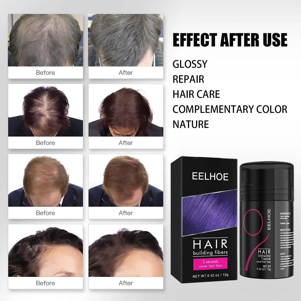 EELHOE Dense Hair Fiber Increase Hair Loss Concealer Instant Hair Shading Powder Hairline Enhancement Hairline Shadow Powder 12g Oasis Select
