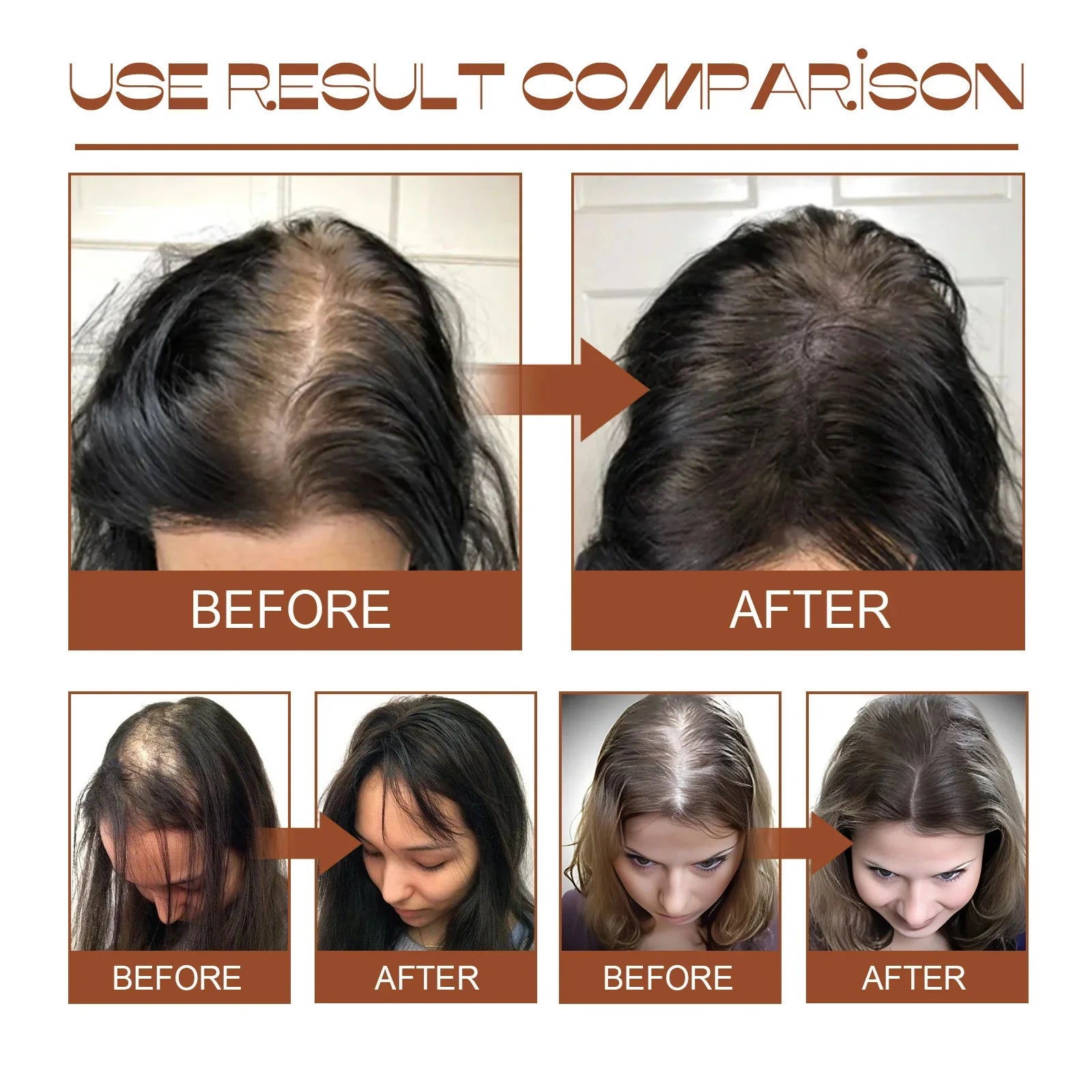 Batana Hair Growth Oil Conditioner Anti Hair Loss Products Fast Growing Hair Mask Nourishing Repair Roots Hair Care for women Oasis Select