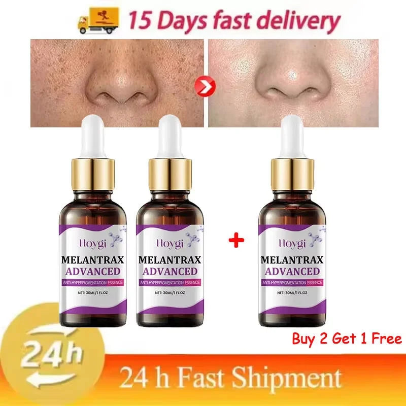 Hoygi Niacinamide Facial Serum Vitamin B3 Wrinkles Pigment Dark Spot Removal Correcting Glow Serum Face Whitening Moisturizer Oasis Select Buy 2 get 1 free