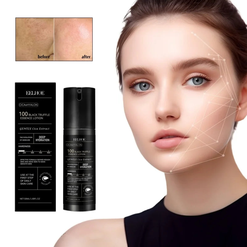 Black Truffle Lotion Essence Soft Radiant Moisturized Skin Centella Oasis Select