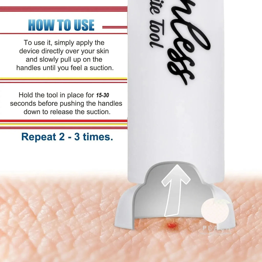Suction Tool, Remover - Bug Bites And Bee/Wasp Stings, Natural Insect Bite Relief, Chemical Free Single Oasis Select