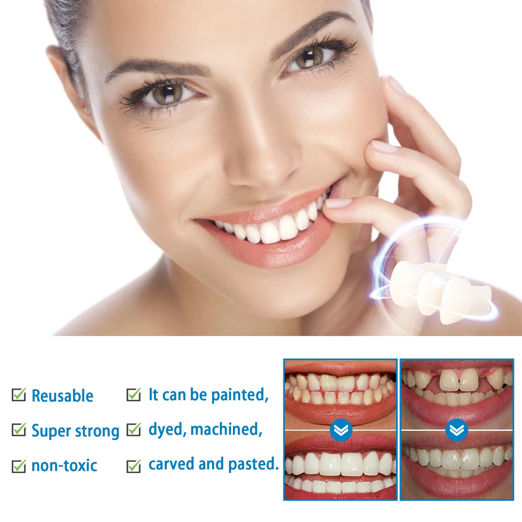 Moldable Tooth Gel Kit – Vampire Teeth & Gap Filler for Cosplay Cosmetic Dental Kit Oasis Select