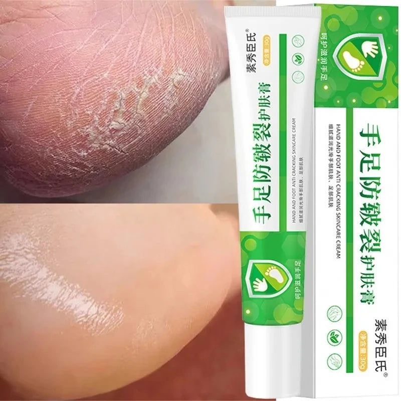 LAIKOU Herbal Foot Cream Spray – Soften & Moisturize Heels