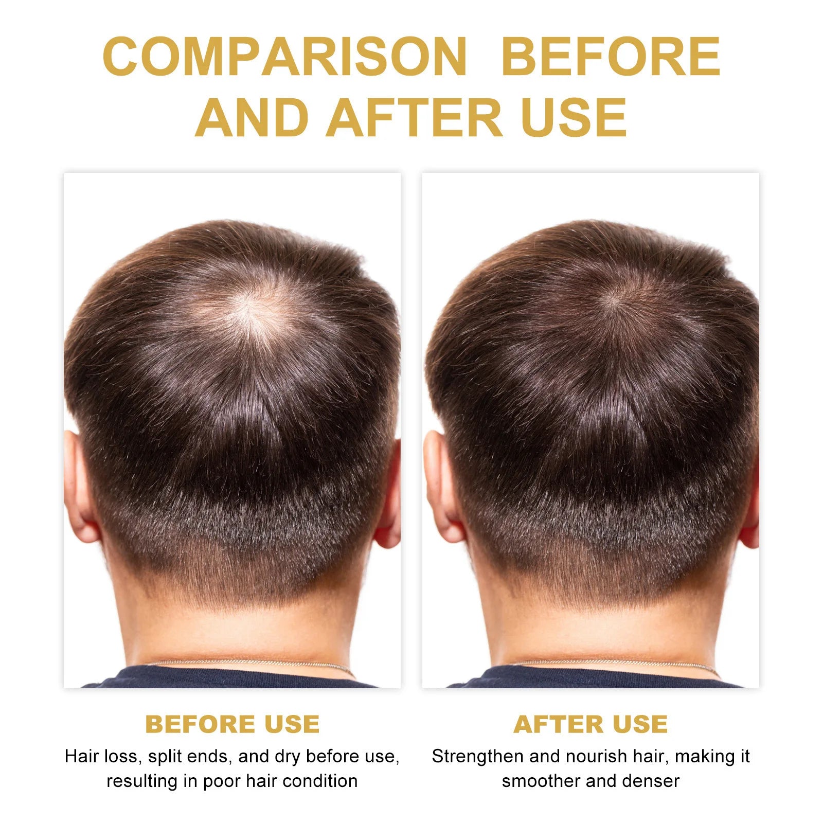 Eelhoe Rosemary Hair Care Series – Shampoo, Conditioner & Oil