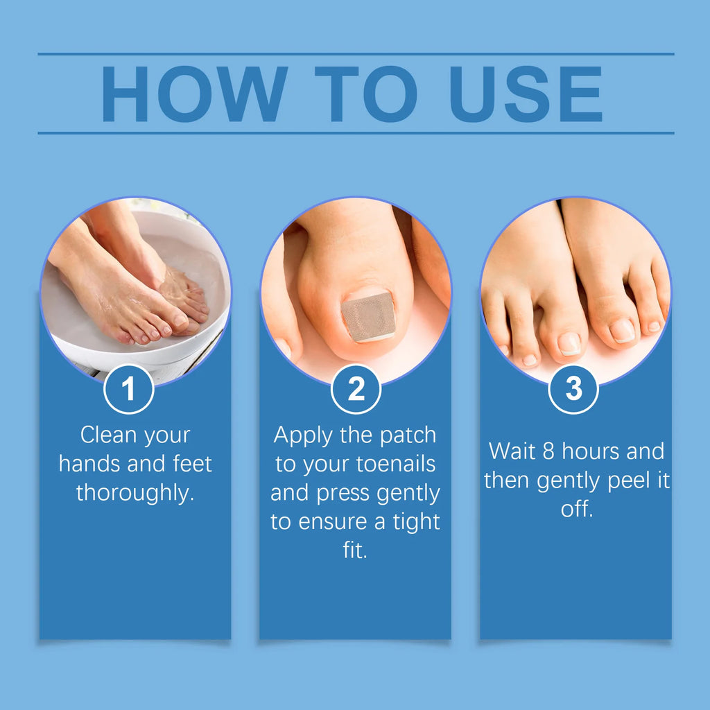 XIMONTH Nail Care Patch Eliminate Dirts Relieve Discomfort Repair Damage Correcte Surface Brightening Luster Nail Nourish Patch Oasis Select