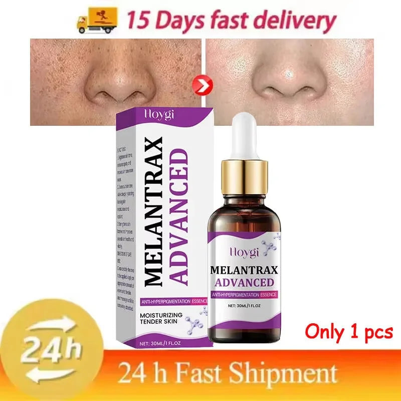 Hoygi Niacinamide Facial Serum Vitamin B3 Wrinkles Pigment Dark Spot Removal Correcting Glow Serum Face Whitening Moisturizer Oasis Select 1pcs
