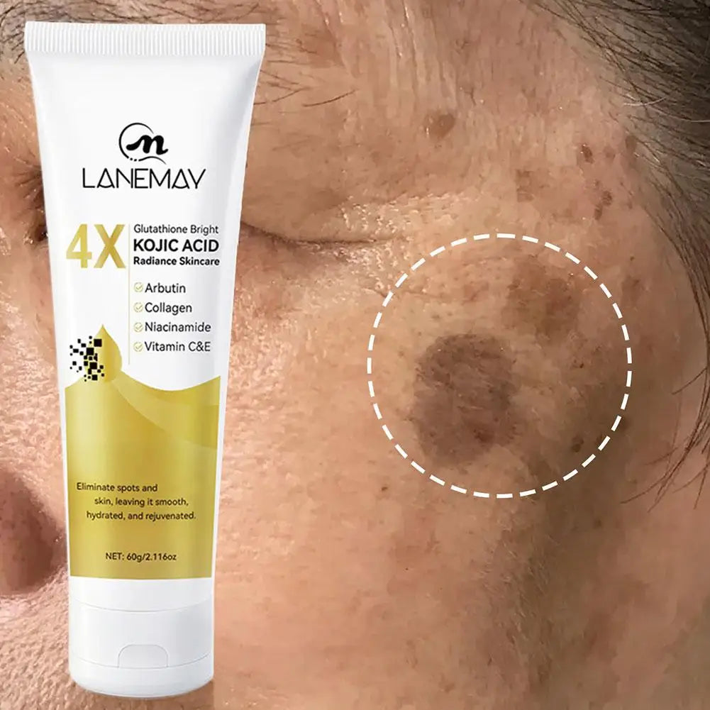 Glutathione Kojic Acid Brightening Cream – Dark Spot Corrector Brightening Face Cream Oasis Select
