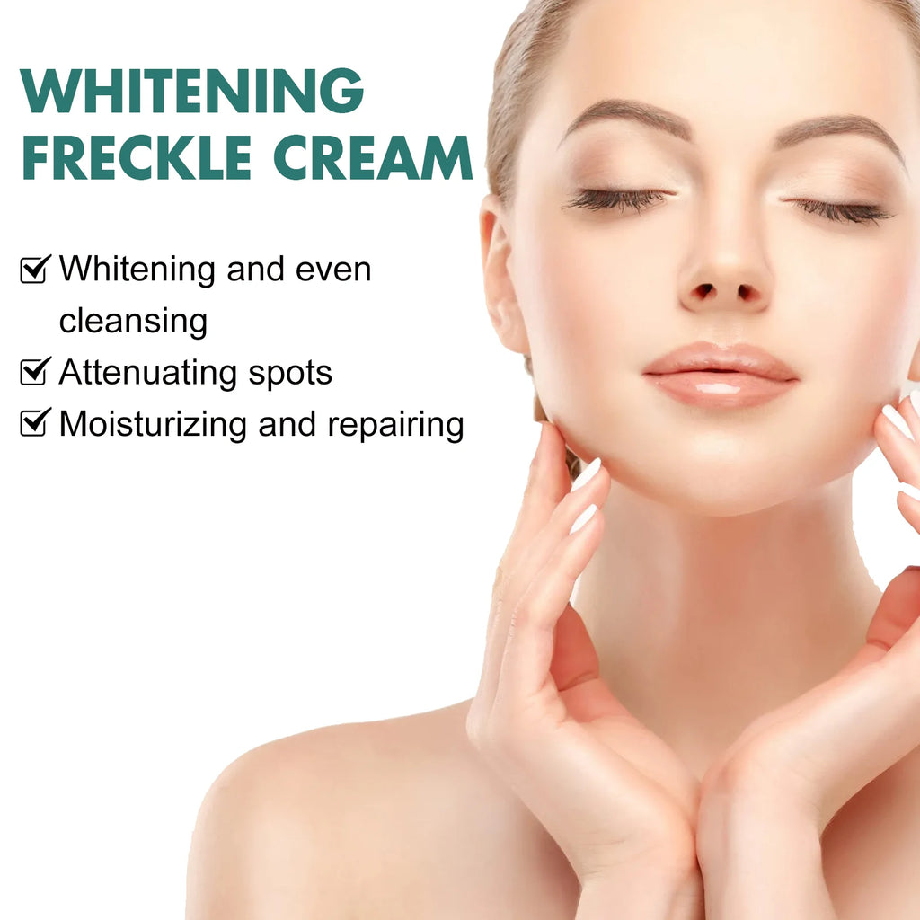 EELHOE Niacinamide Freckle & Melasma Removal Cream 30g