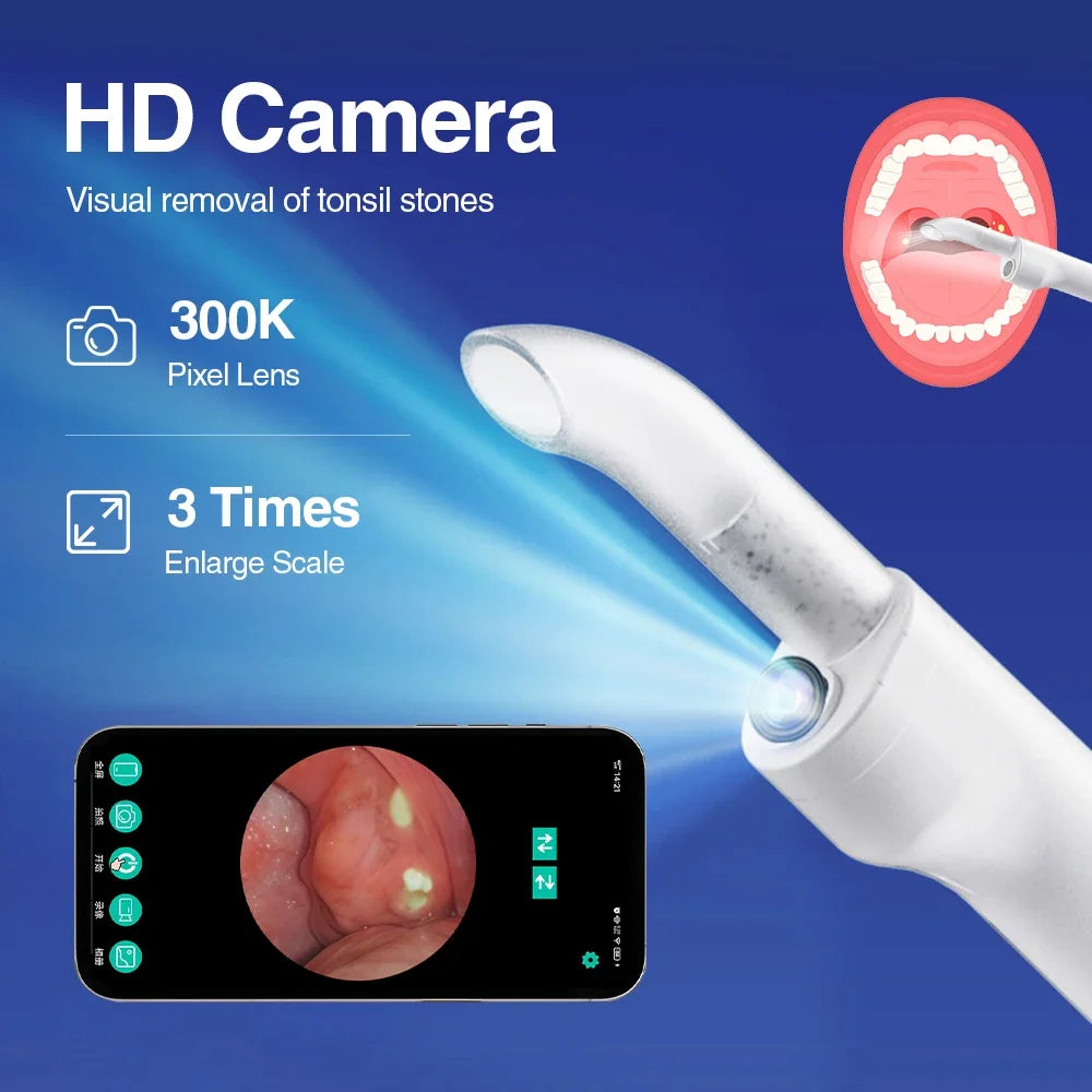 Electric Tonsil Stone Remover – 300K HD Camera & LED Light