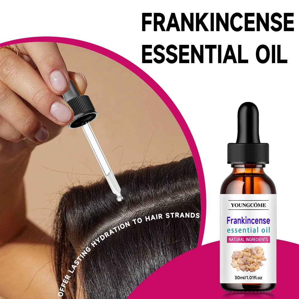 Frankincense Essential Oil – Scalp, Hair & Aromatherapy Hair & Scalp Oil Oasis Select