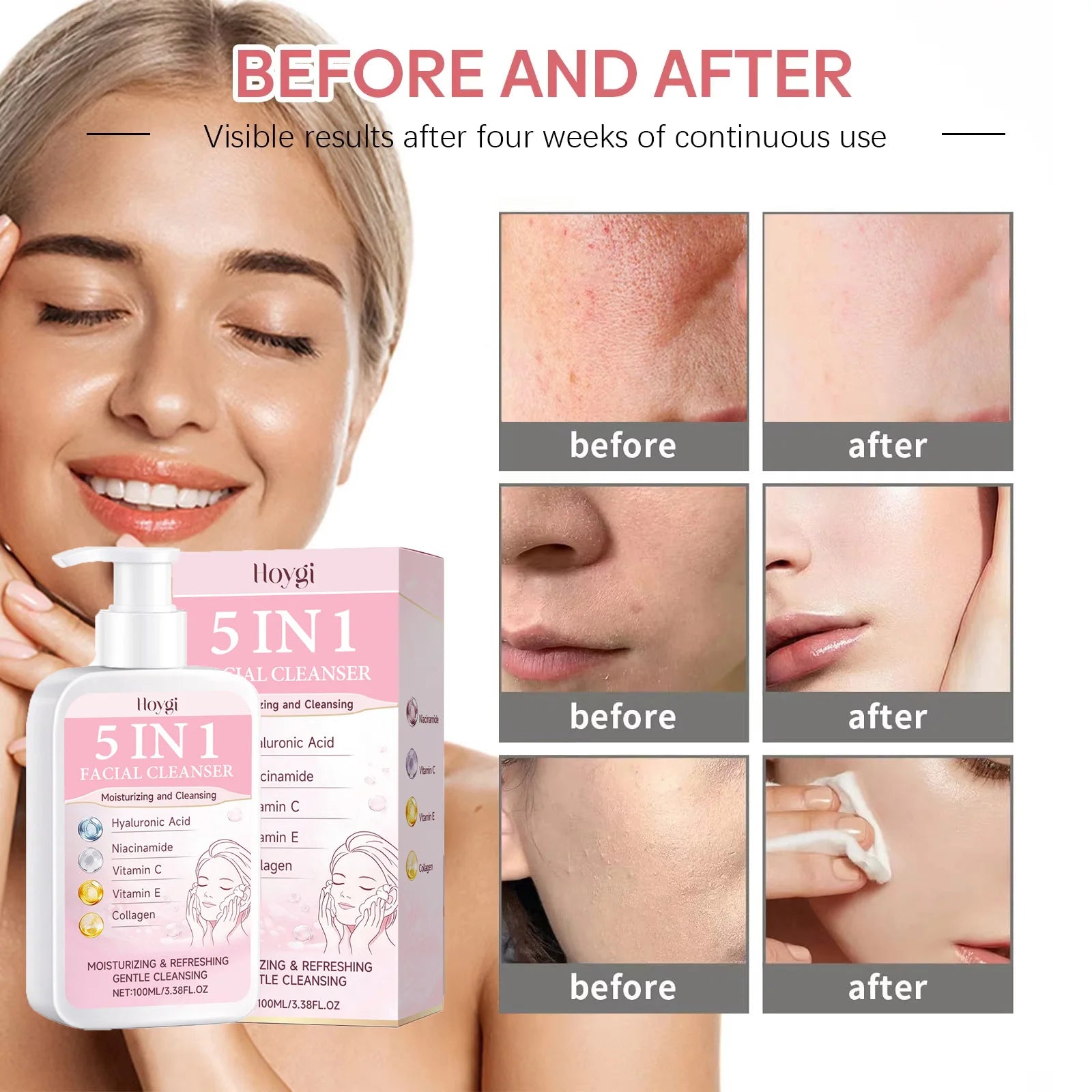 5 in 1 Moisturizing Facial Cleanser Refreshed Cleansing Makeup Remover Brightening Hydrating Light Texture Rich Foam Cleanser Oasis Select