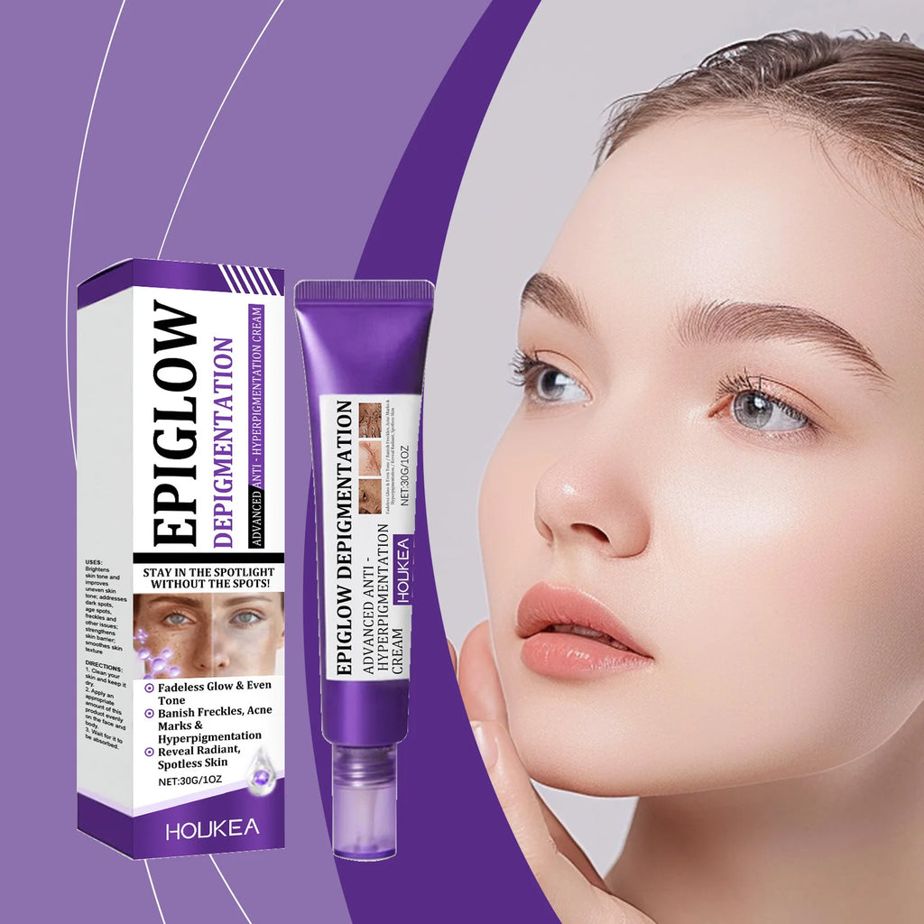 HOUKEA Whitening Freckle Cream – Dark Spots & Melasma Brightening Face Cream Oasis Select