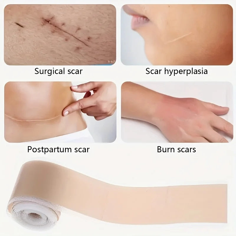 Silicone Scar Tape Roll ， Silicone Gel Tape And Concealing Scars, Scar Cover Up Adhesive Tape for Surgical Oasis Select
