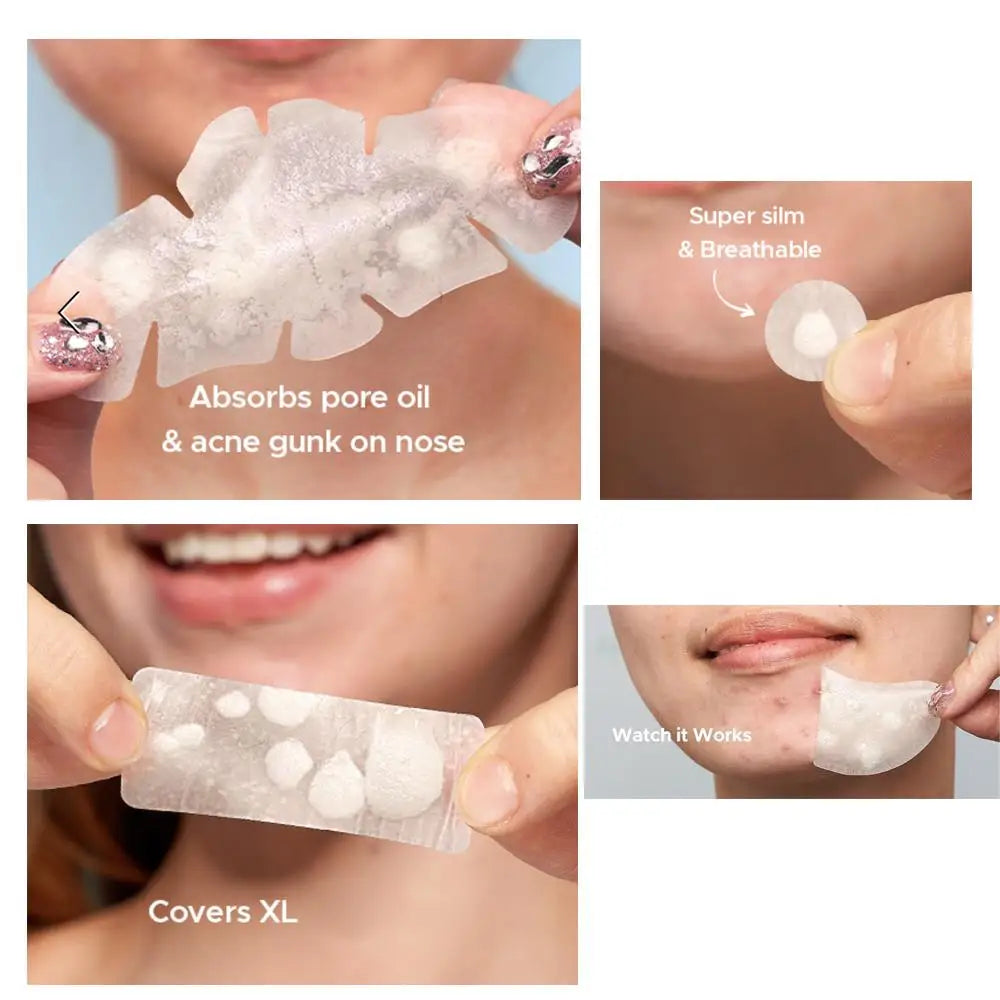 Large Pimple Patches for Face, Big Hydrocolloid Acne Patches for Body, Forehead, Chin, Zit Breakouts (Strip, Contoured, Dots) Oasis Select