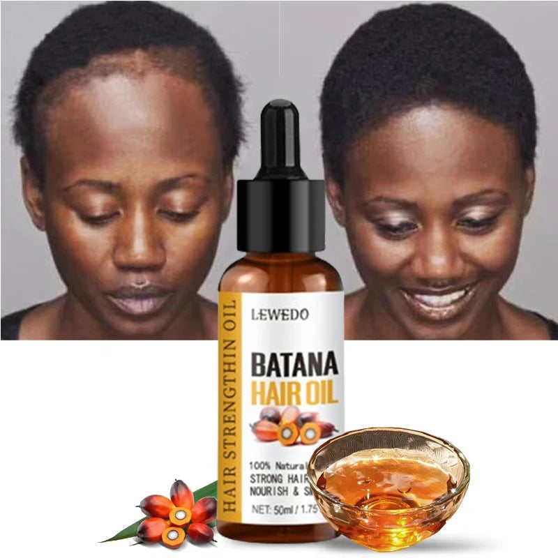 Lewedo Naturals Batana Oil Fast Hair Growth for Men Women Pure Batana Oil Nourish Shiny Hair Healthy Hair Care Anti Hair Loss Oasis Select