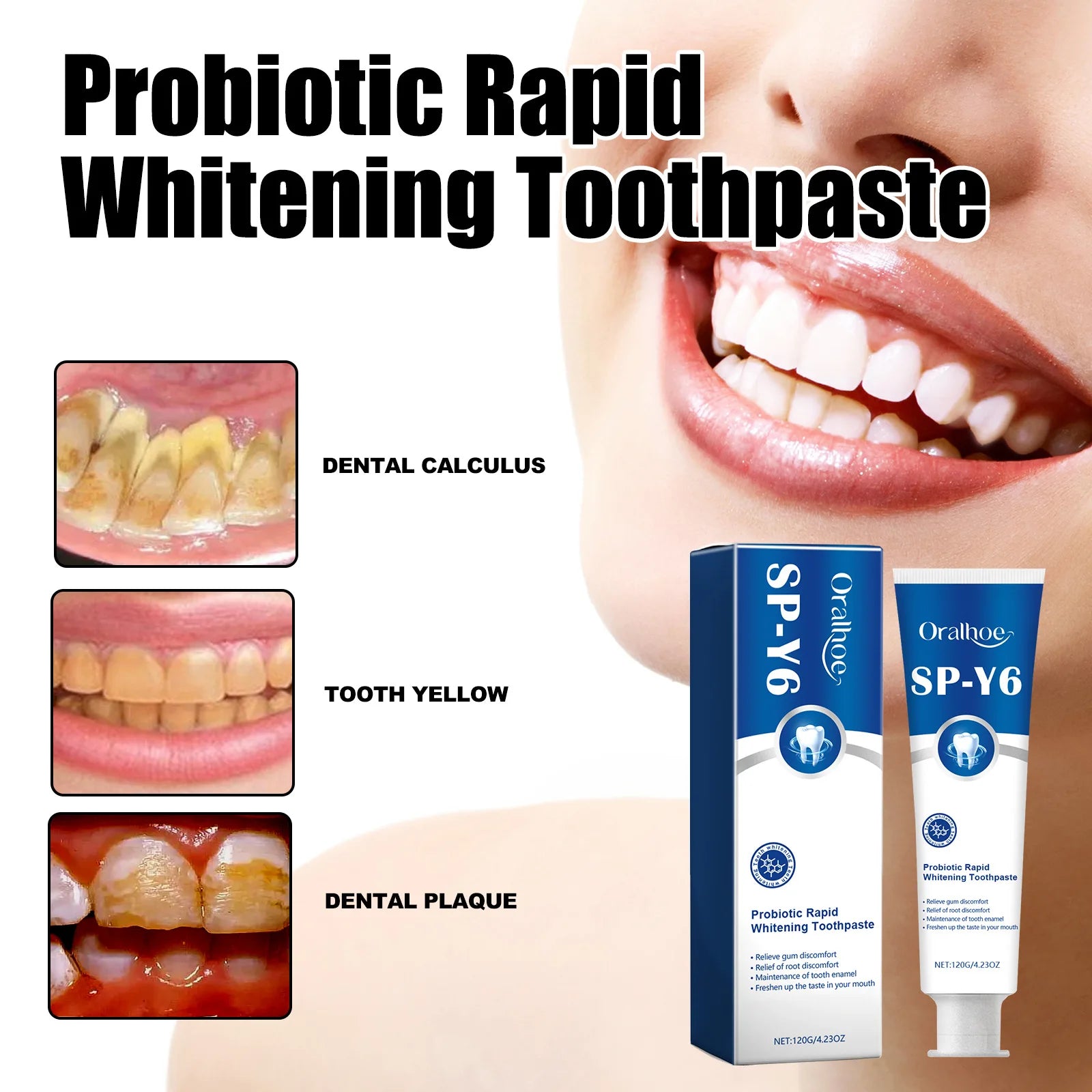 Oralhoe Probiotic W-hitening Toothpaste Fresh Breathing Deep Cleansing Remove Yellow Plaque Stains Teeth Brightening Toothpaste Oasis Select