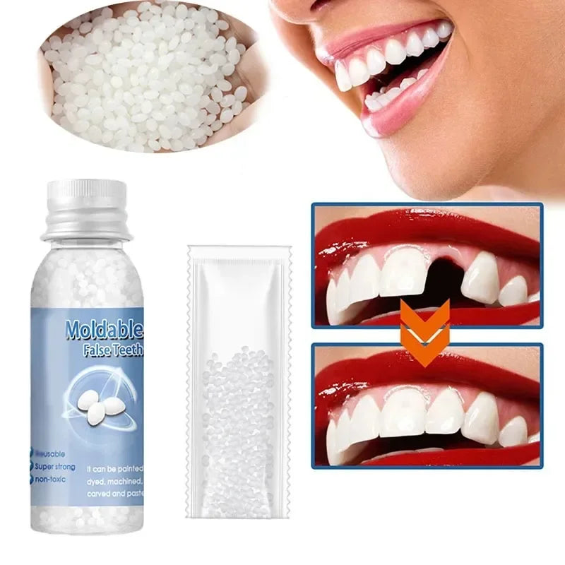 Temporary Tooth Repair Kit – Resin Denture Adhesive & Gap Filler Tooth Repair Kit Oasis Select
