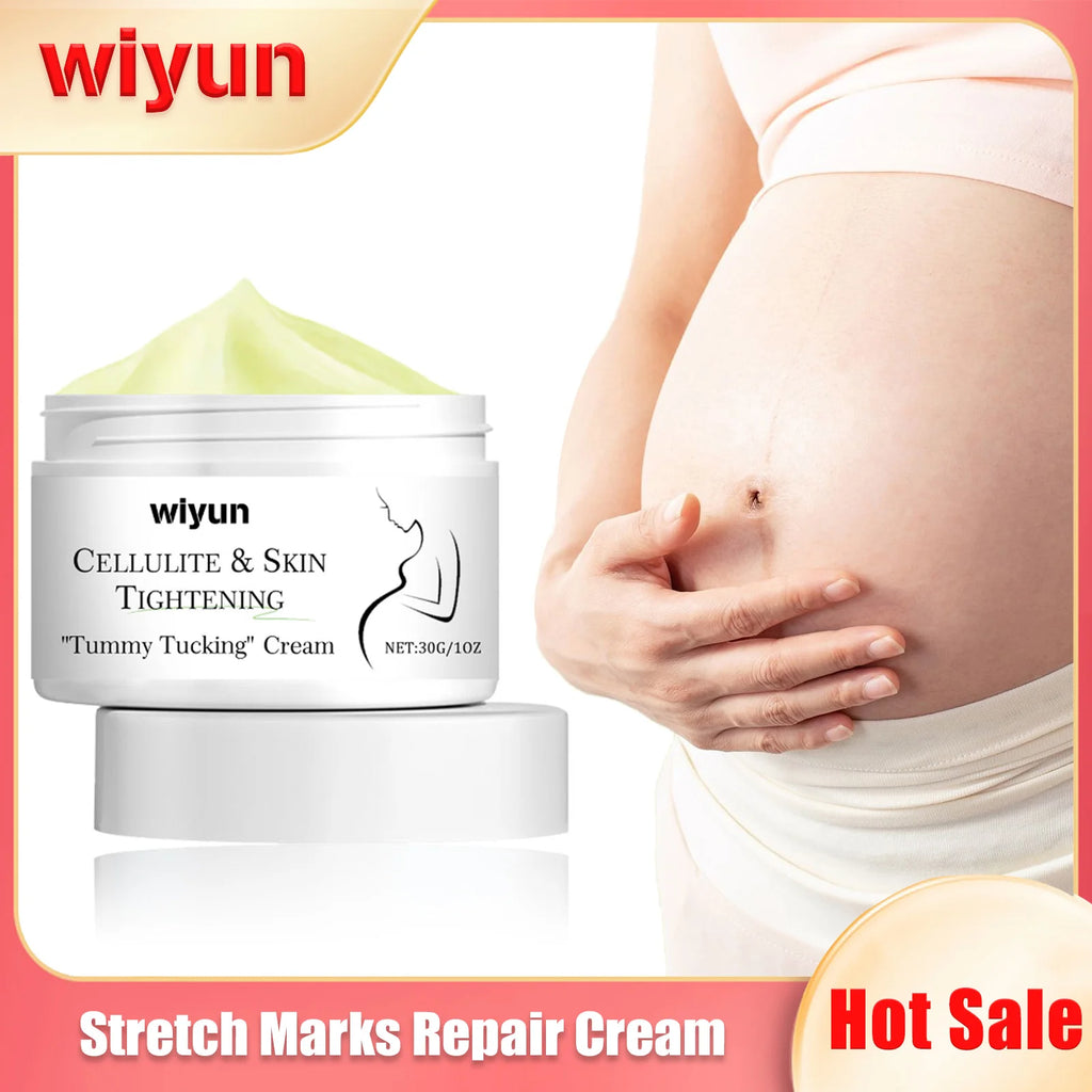 Remove Stretch Marks Cream Pregnant Women Repair Anti-Aging Anti-Winkles Sagging Increase Skin Elasticity Smoothing Firm Cream Oasis Select