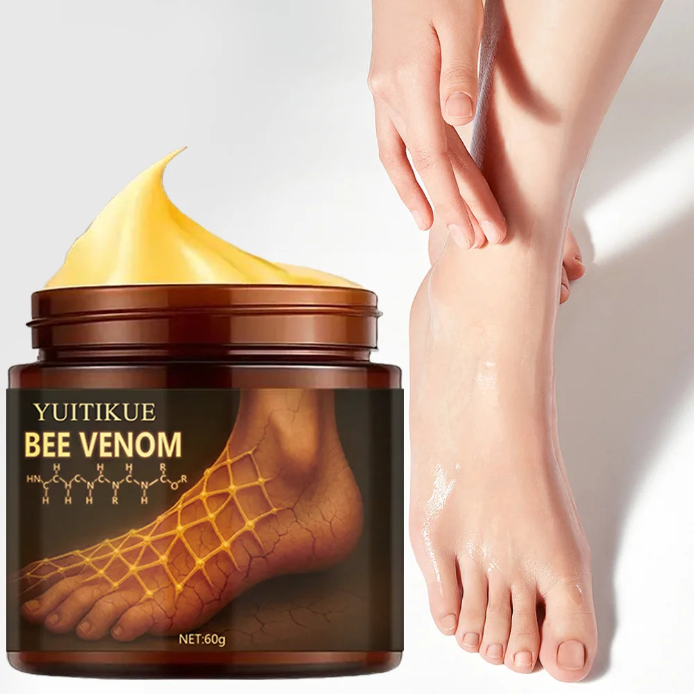 Urea Foot Cream 100g – Dry Heels, Hands & Elbows Relief
