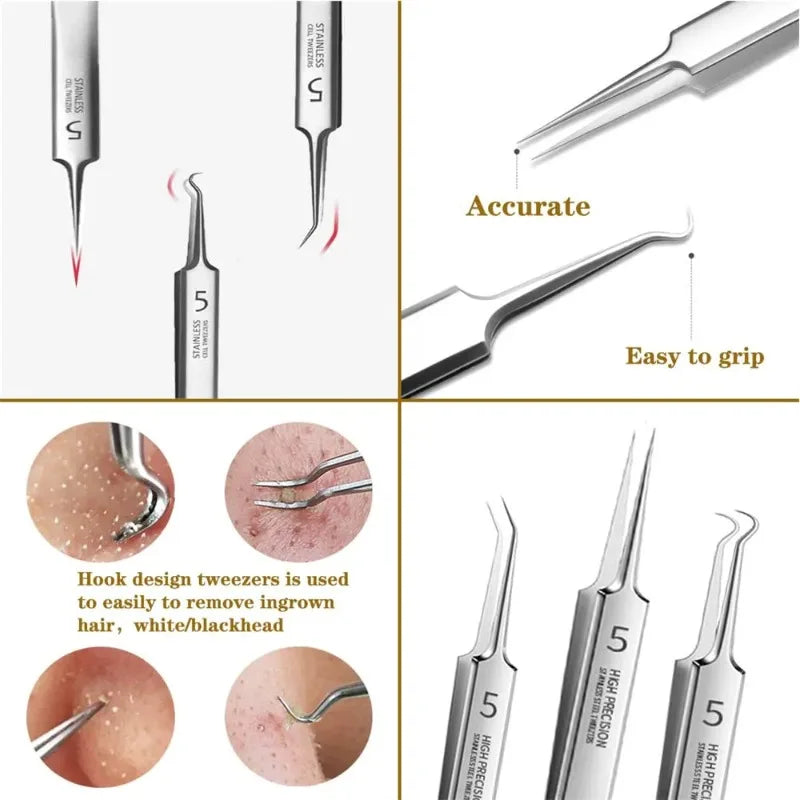 German Ultra-fine No. 5 Cell Pimples Blackhead Clip Tweezers Beauty Salon Special Scraping & Closing Artifact Acne Needle Tools Oasis Select