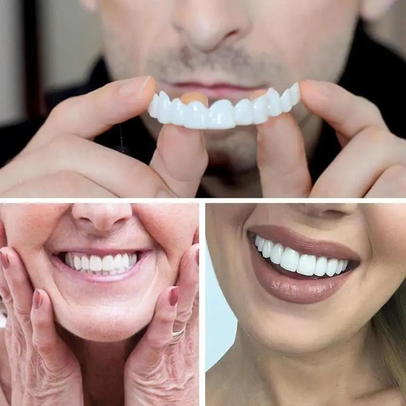 Snap-On Teeth Veneers – Reusable Smile Cover for Men & Women Cosmetic Dental Veneers Oasis Select