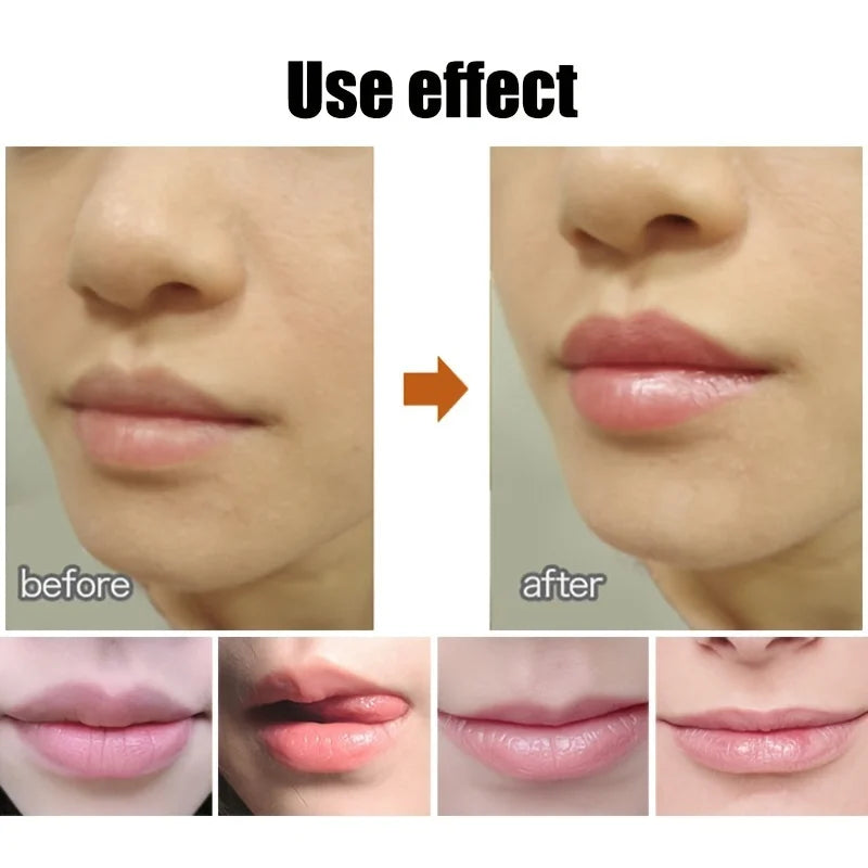 Ball Shaped Lip Balm – Hydrating, Nourishing & Long-Lasting