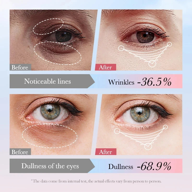 SADOER 4-in-1 Roll-On Eye Cream | Retinol, Vitamin C & Niacinamide Eye Cream Serum Oasis Select