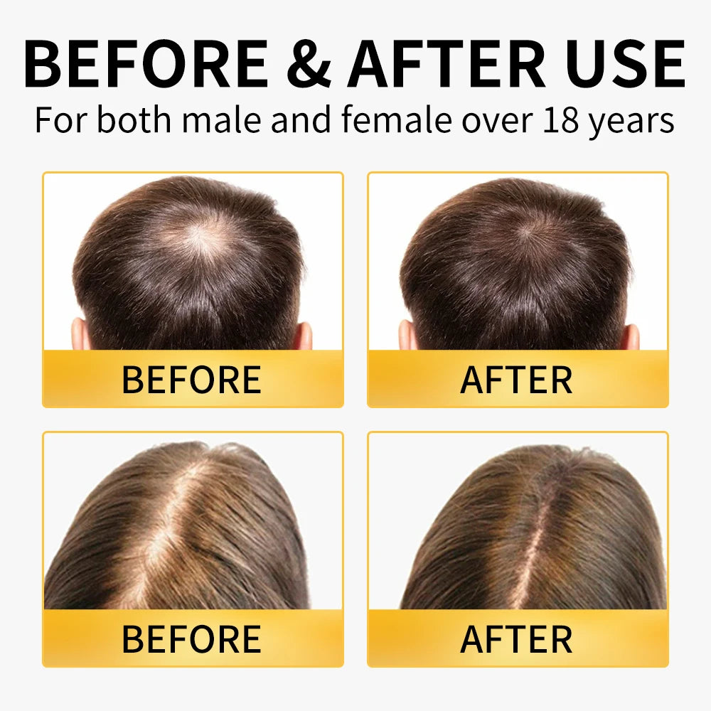 Ginger Shampoo & Conditioner Set for Thinning Hair | Men & Women Hair Care Set Oasis Select