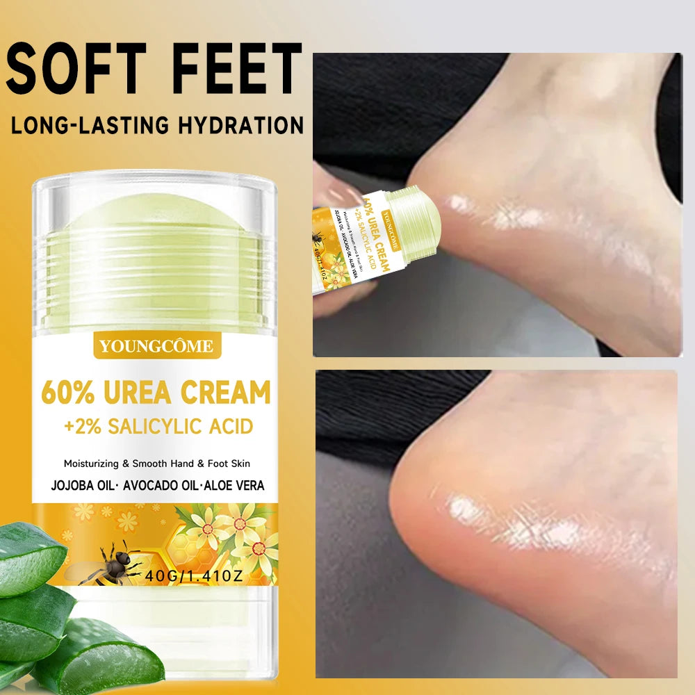 YOUNGCOME 60% Urea Body Cream – Exfoliating & Hydrating, 40g