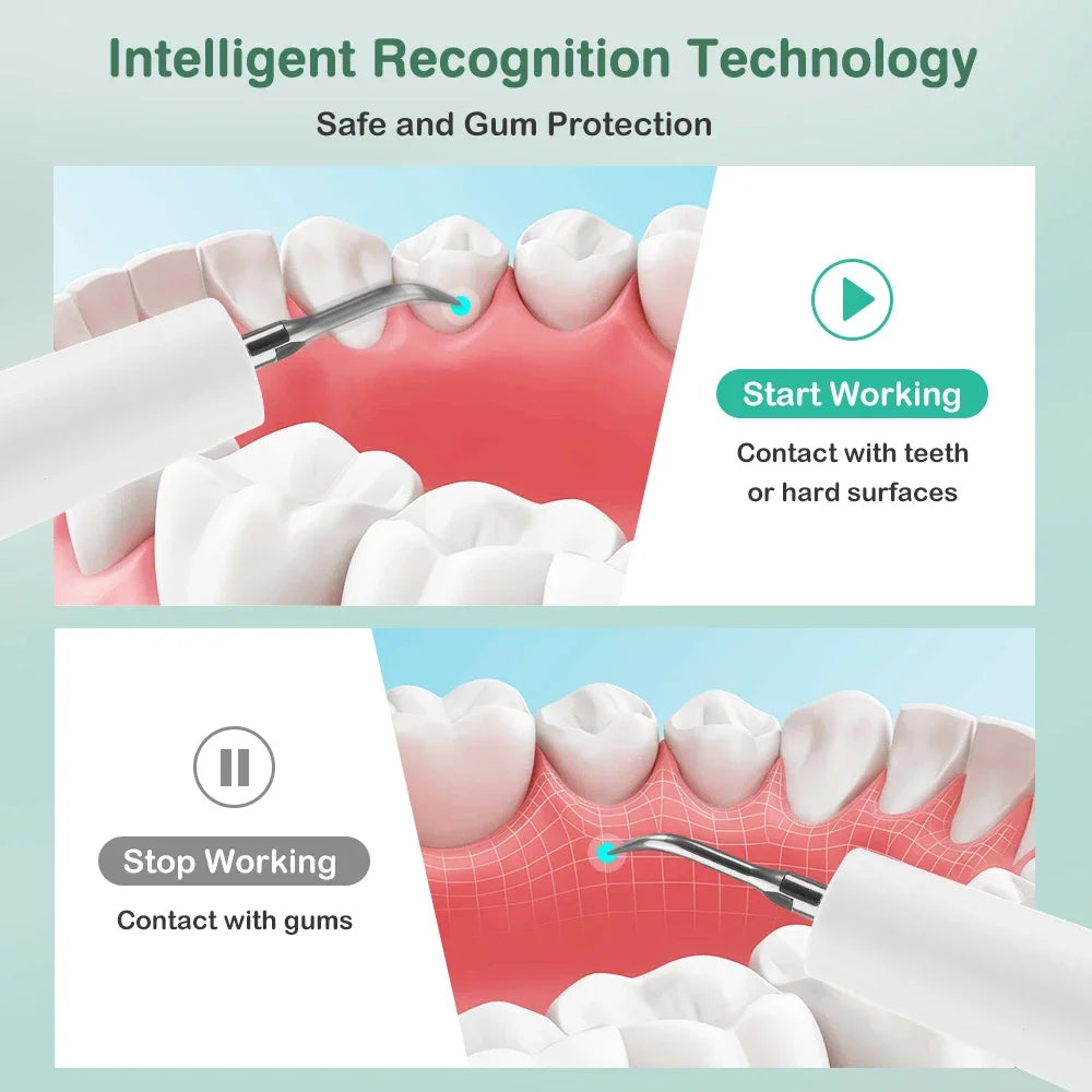 AFDEAL Ultrasonic Dental Scaler – 5 Modes, 9 Levels, Tartar Remover