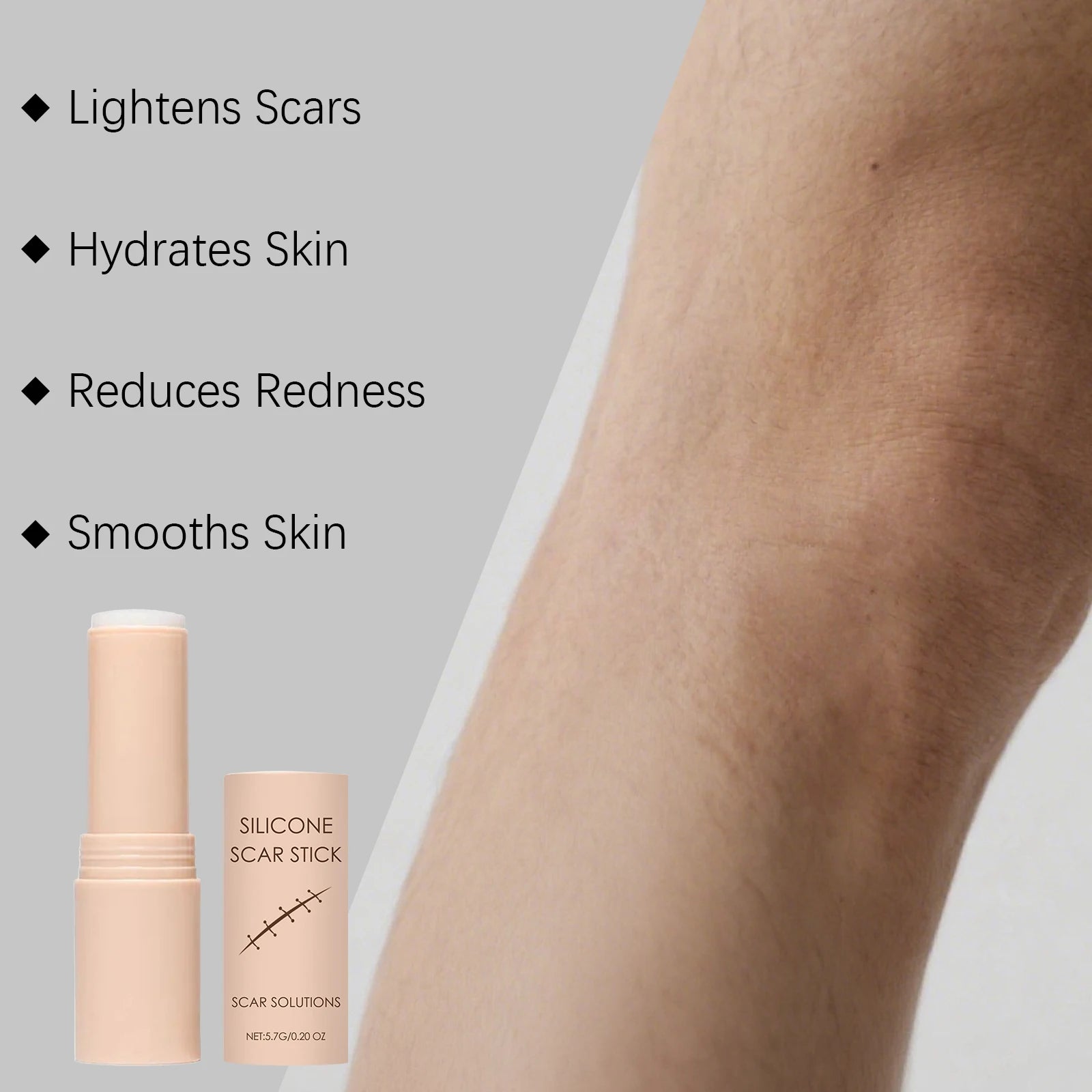 Scar Care Moisturizing Stick – Hydrating Balm Face & Body Scar Care Balm Oasis Select