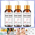 AHA 30% BHA 2% Exfoliating Face Peel Serum | YOUNGCOME Face Peel Serum Oasis Select 60ml-3pcs