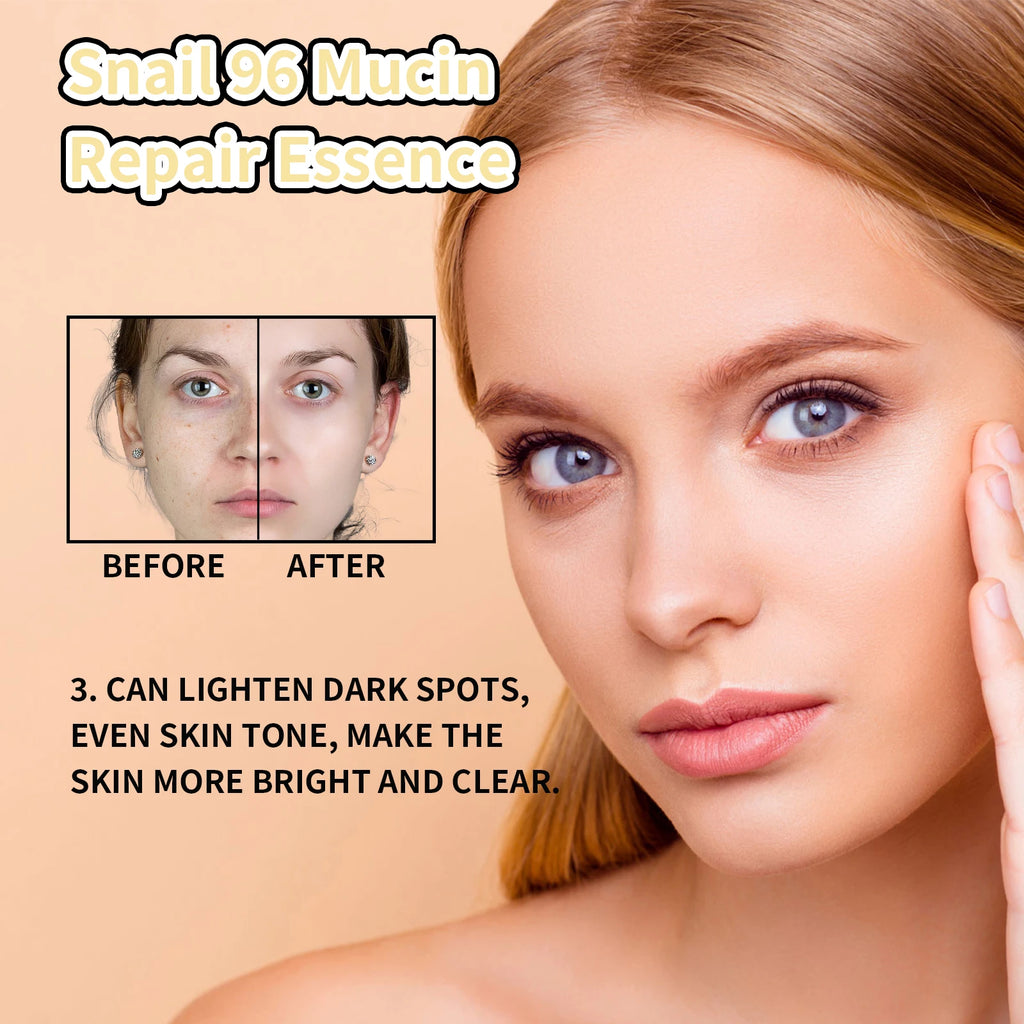 Snail Mucin Face Serum – Hyaluronic Acid & Collagen Anti-Aging