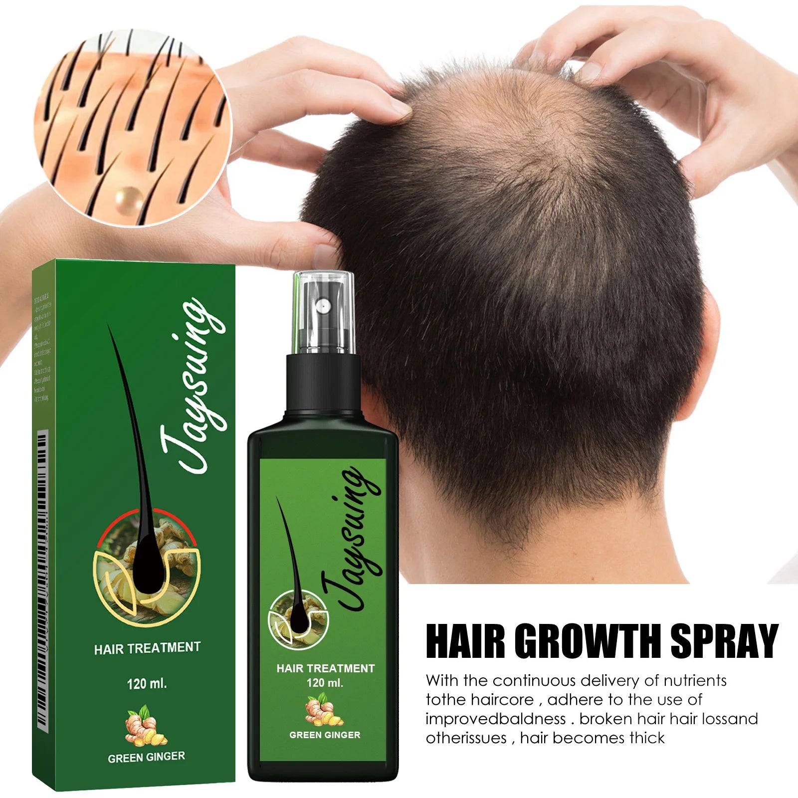 Ginger Hair Growth Serum Spray Scalp Treatment Nourish Hair Root Strengthen Prevent Loss Repair Follicle Smooth Essence Nutrient Oasis Select