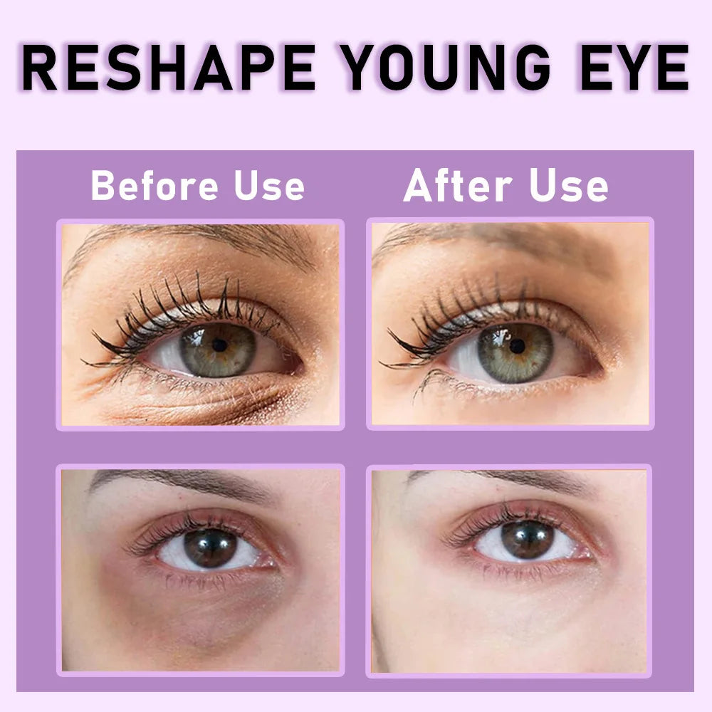 Retinol Firming Eye Cream | Collagen & Niacinamide, 20ml Eye Cream Oasis Select