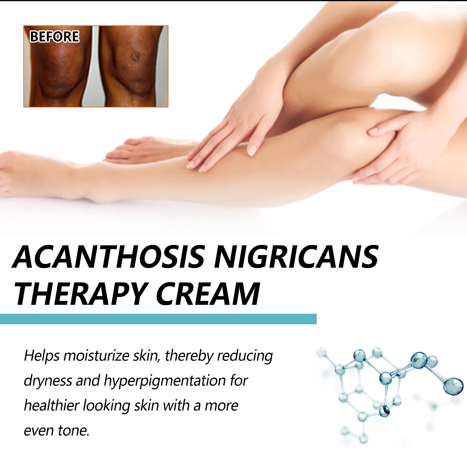 EELHOE Whitening Cream Brightening Skin For Dark Skin Neck Arm Knee Joint Underarm Body Care Acanthosis Nigricans Therapy Cream Oasis Select