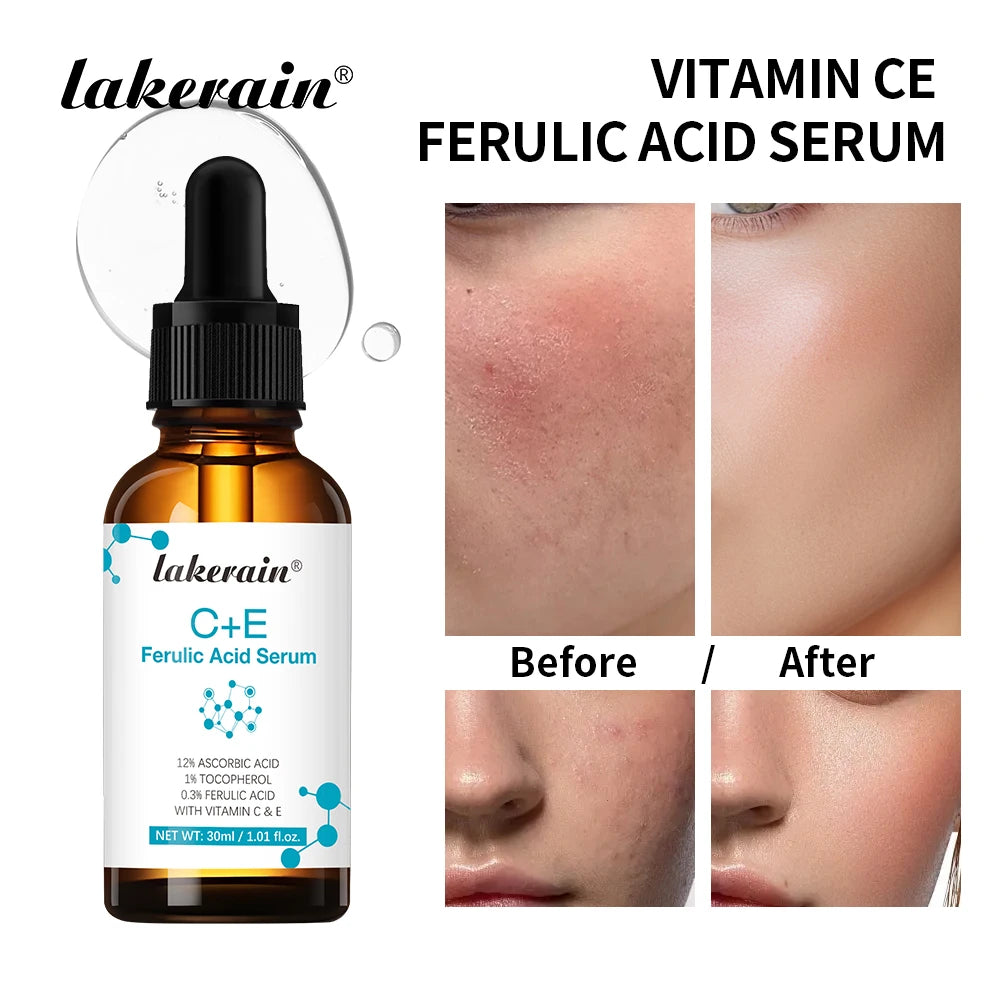 Vitamin C Face Serum Reduce Dark Spots Acne Scars Provides Firming Diminishes Fine Lines Facial Essence Korean Skin Care Product Oasis Select