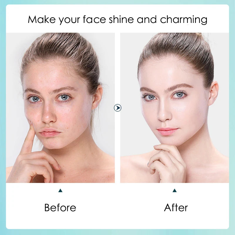 BIOAOUA Hyaluronic Acid Sheet Masks 10-Pack – Hydrate & Pores Hydrating Sheet Mask Oasis Select
