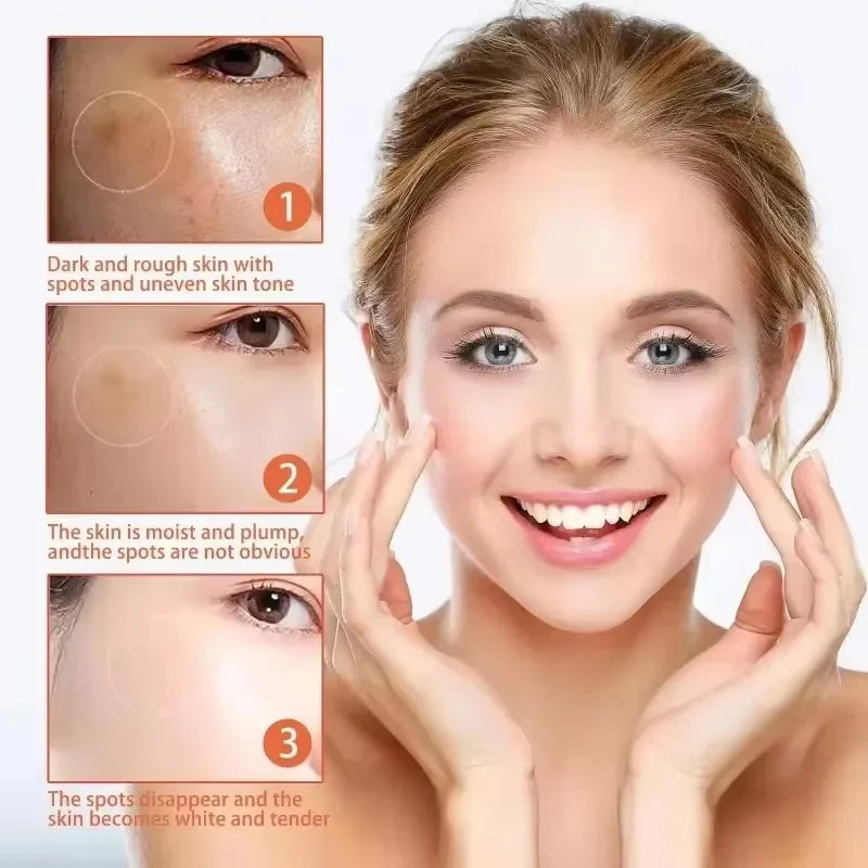 Nicotinamide Brightening Cream – Dark Spot & Tone Corrector