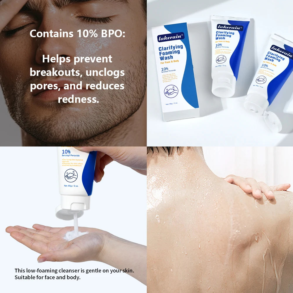 Acne Foaming Wash Benzoyl Peroxide 10% Maximum Antimicrobia Moisturizers reduces redness For Face & Body Skin Care Face Wash Oasis Select