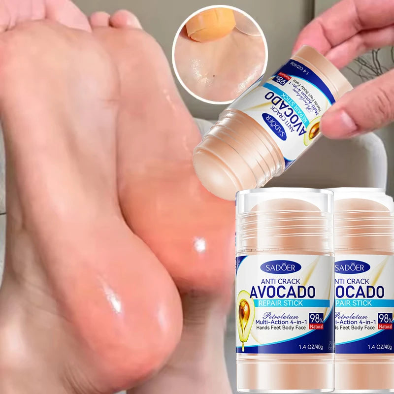 60% Urea Foot Cream with Aloe Vera – Deep Hydration 40g