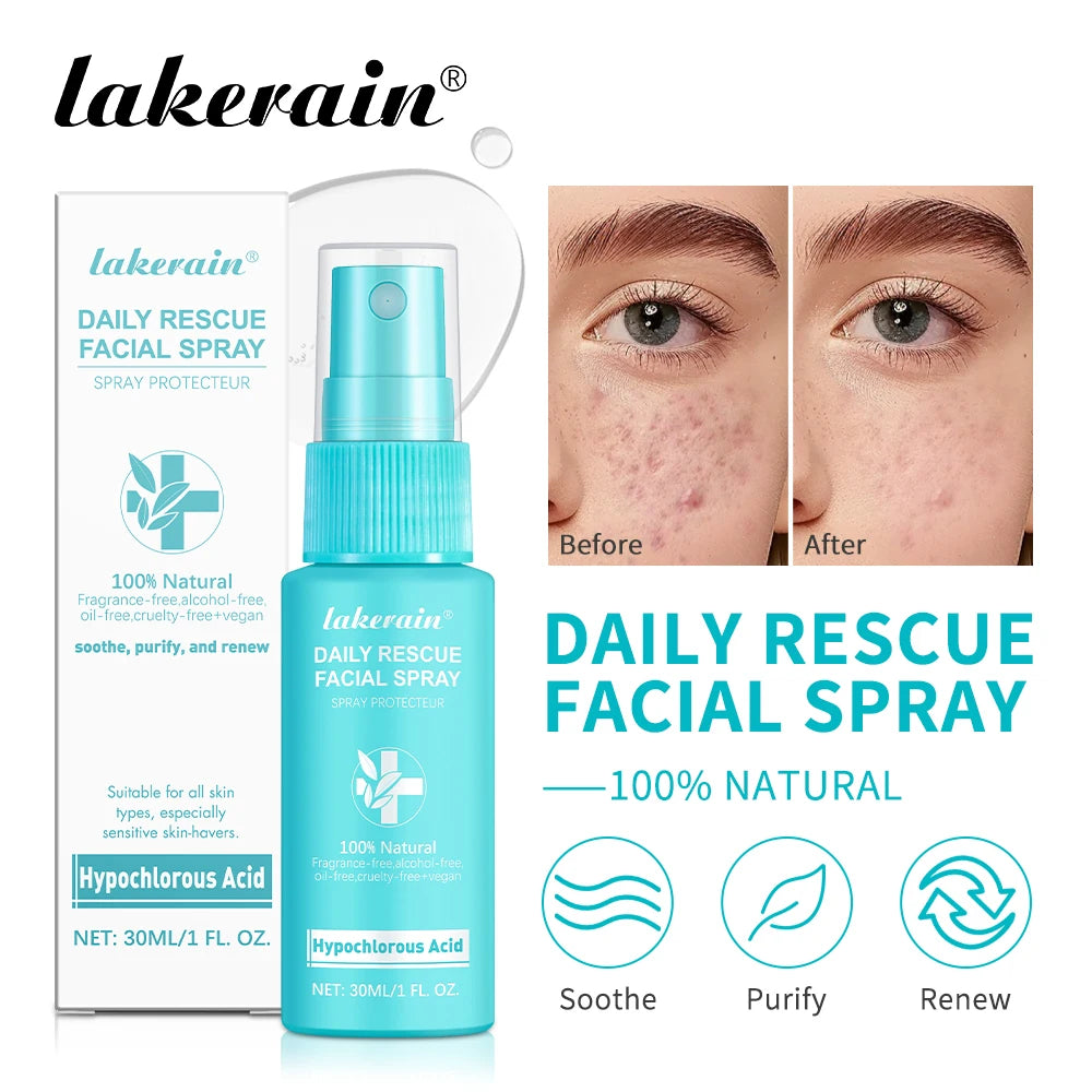Calming Rescue Facial Spray For Sensitive Skin Hypochlorous Acid Spray Helps Reduce Redness Breakouts Soothing Balancing Spray Oasis Select
